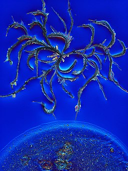 Crystals_of_IgG_antibodies